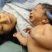 Mortalidade materna: Brasil ainda perde centenas de mulheres por ano